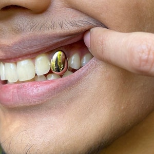 Gold on sale teeth price