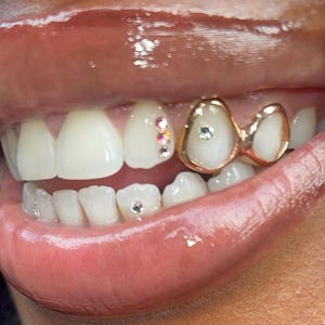 Puede incluir: Primer plano de la boca de una persona con grillz de oro y diamantes de imitaci&oacute;n en los dientes.
