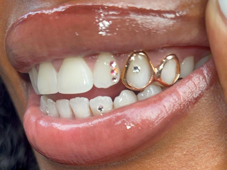 Puede incluir: Primer plano de la boca de una persona con grillz de oro y diamantes de imitaci&oacute;n en los dientes.