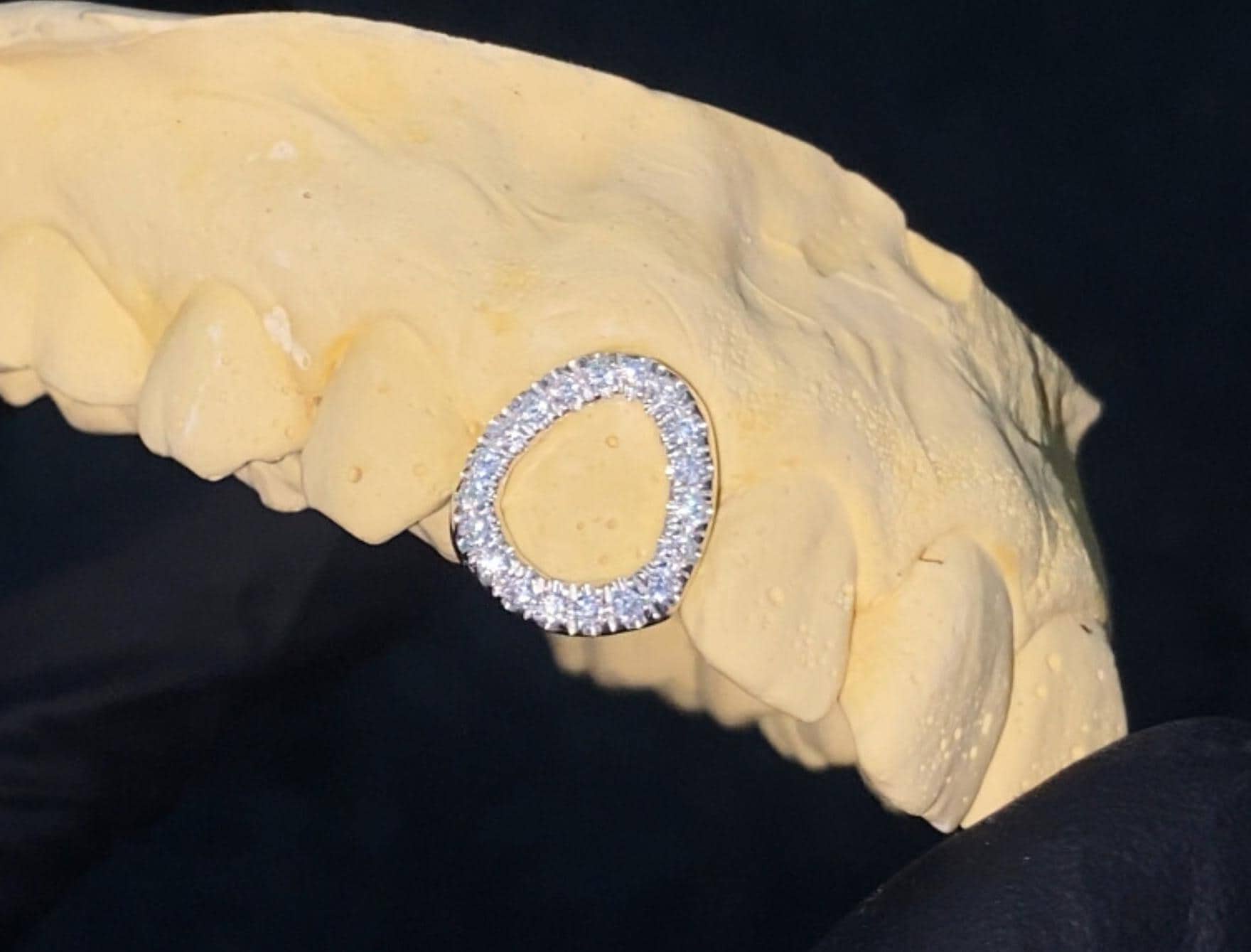 Iced Out Diamond Window Tooth Cap Grillz UK Worldwide Shipping!