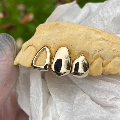 Single Dental Gold Tooth Cap Grillz Tarnish Free Etsy UK