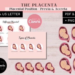 Puede incluir: Una infografía rosa y blanca que ilustra diferentes posiciones de la placenta durante el embarazo. La infografía incluye ilustraciones de la placenta en varias ubicaciones dentro del útero, incluyendo anterior, posterior, fundal y baja. La infografía también incluye ilustraciones de diferentes tipos de placenta previa, incluyendo marginal, parcial y completa.