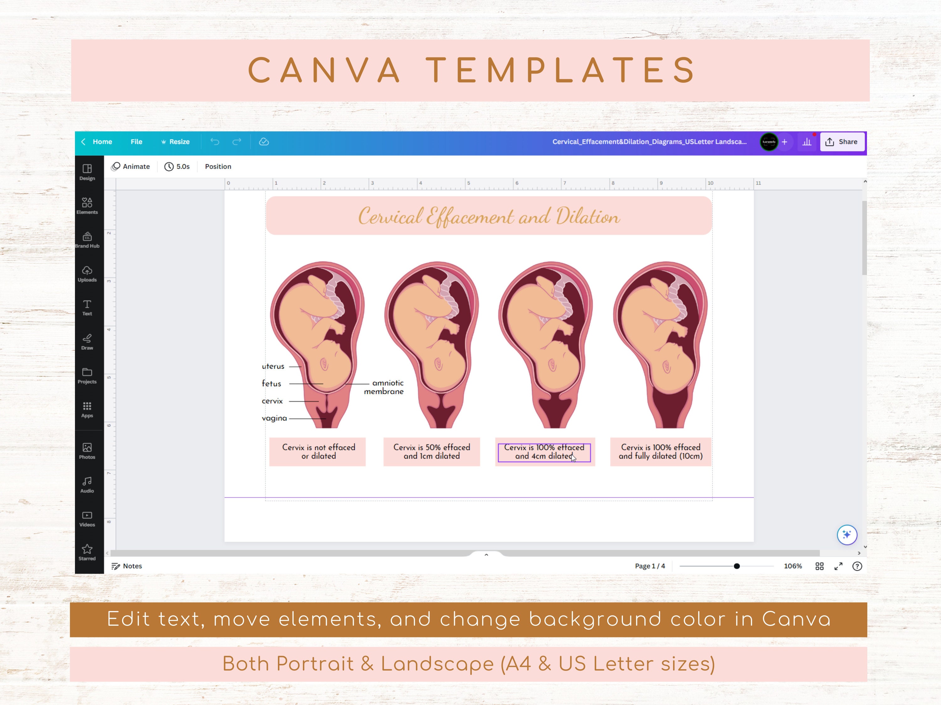 Cervical Effacement and Dilation PNG Images & Canva PDF JPG Female