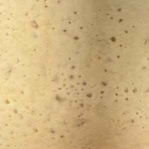May include: Close-up of a light beige surface with numerous small brown spots.