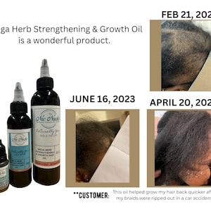 Mega Herb Strengthening & Growth Oil, Hair Loss,