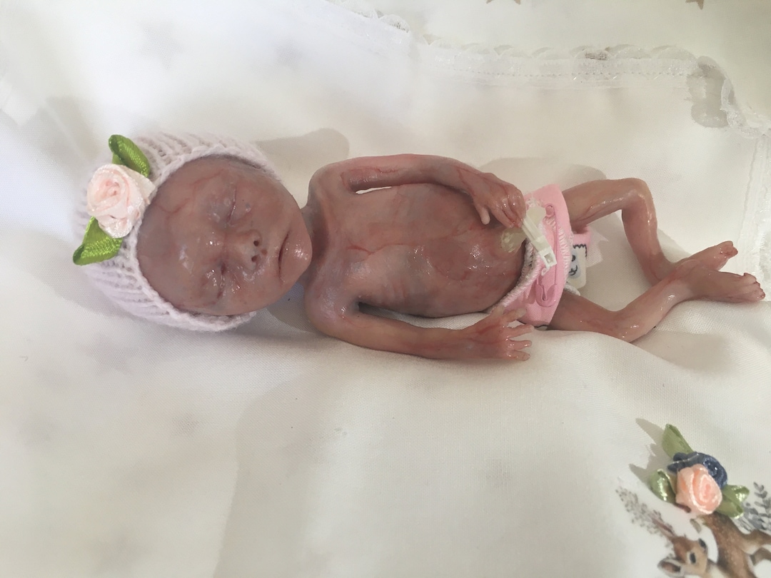 Small online baby at 20 weeks