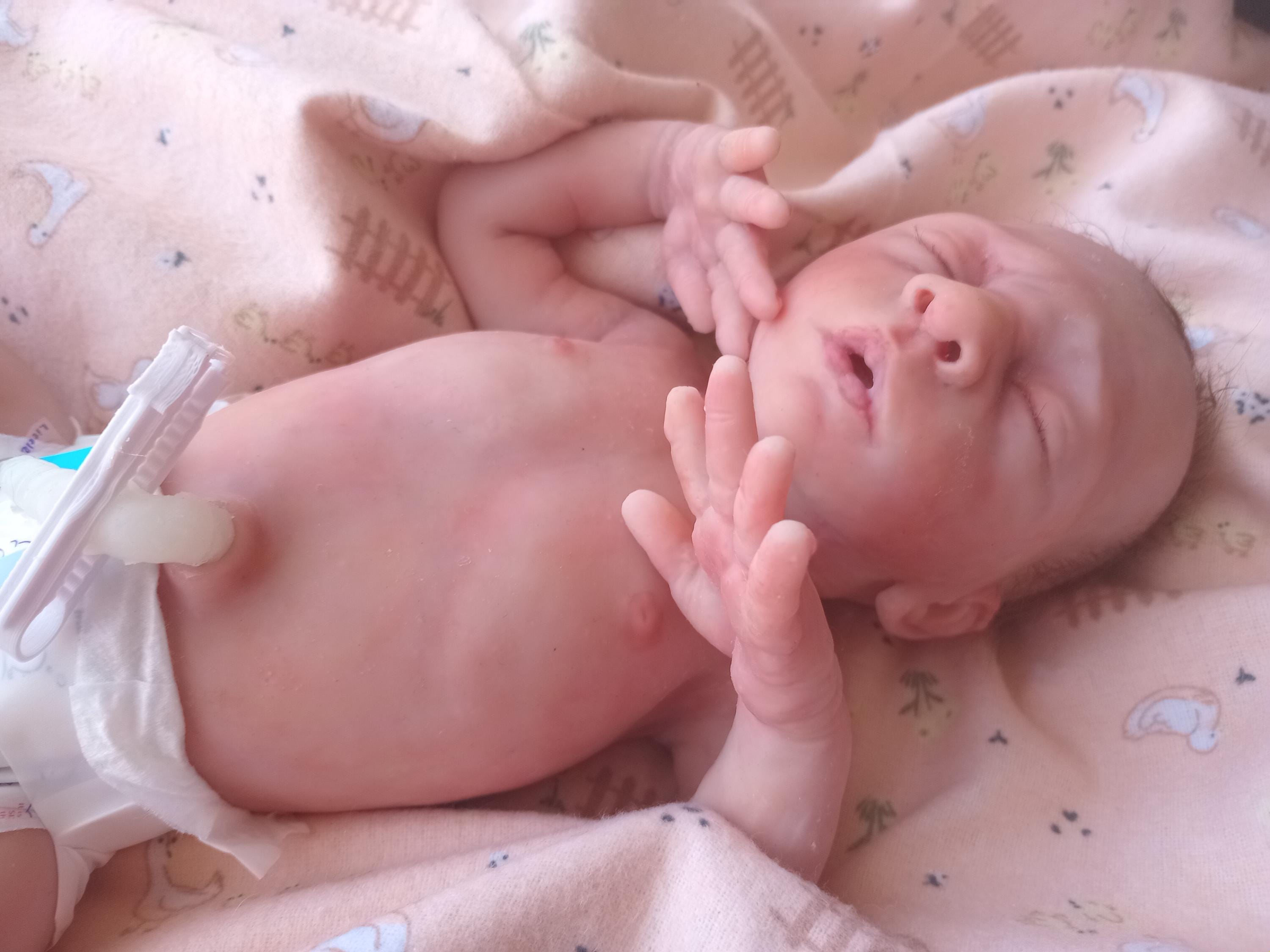 熊本NICUからの近況報告(8月) - 日記, image size:3000x2250