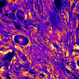 May include: A microscopic image of cells in a purple and orange colour scheme. The cells are elongated and have a striated appearance. The image is likely from a scientific study.