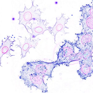 Puede incluir: Imagen microscópica de células teñidas de azul y rosa. Las células tienen una forma de estrella con muchos brazos.