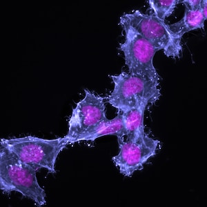 Op de afbeelding: Een microscopische afbeelding van cellen, die een netwerk van blauwe filamenten met meerdere roze kernen laat zien. De cellen zijn met elkaar verbonden en vormen een kettingachtige structuur.