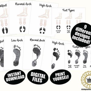 Footprint Types Podiatry BUNDLE, Foot Arch Types Medical Posters, Orthopedist Foot Pathology Wall Art, Orthopedic Clinic Foot Poster Digital