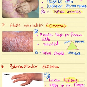 May include: Handwritten notes on a yellow lined paper with images of skin conditions. The notes include the names of the conditions, such as Psoriasis, Atopic Dermatitis (Eczema), and Palmoplantar Eczema. The notes also include the symptoms and treatment options for each condition.