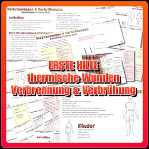 158 First Aid Thermal Wounds Burns & Scalds Summary A4, Flashcards A6 as PDF for printing