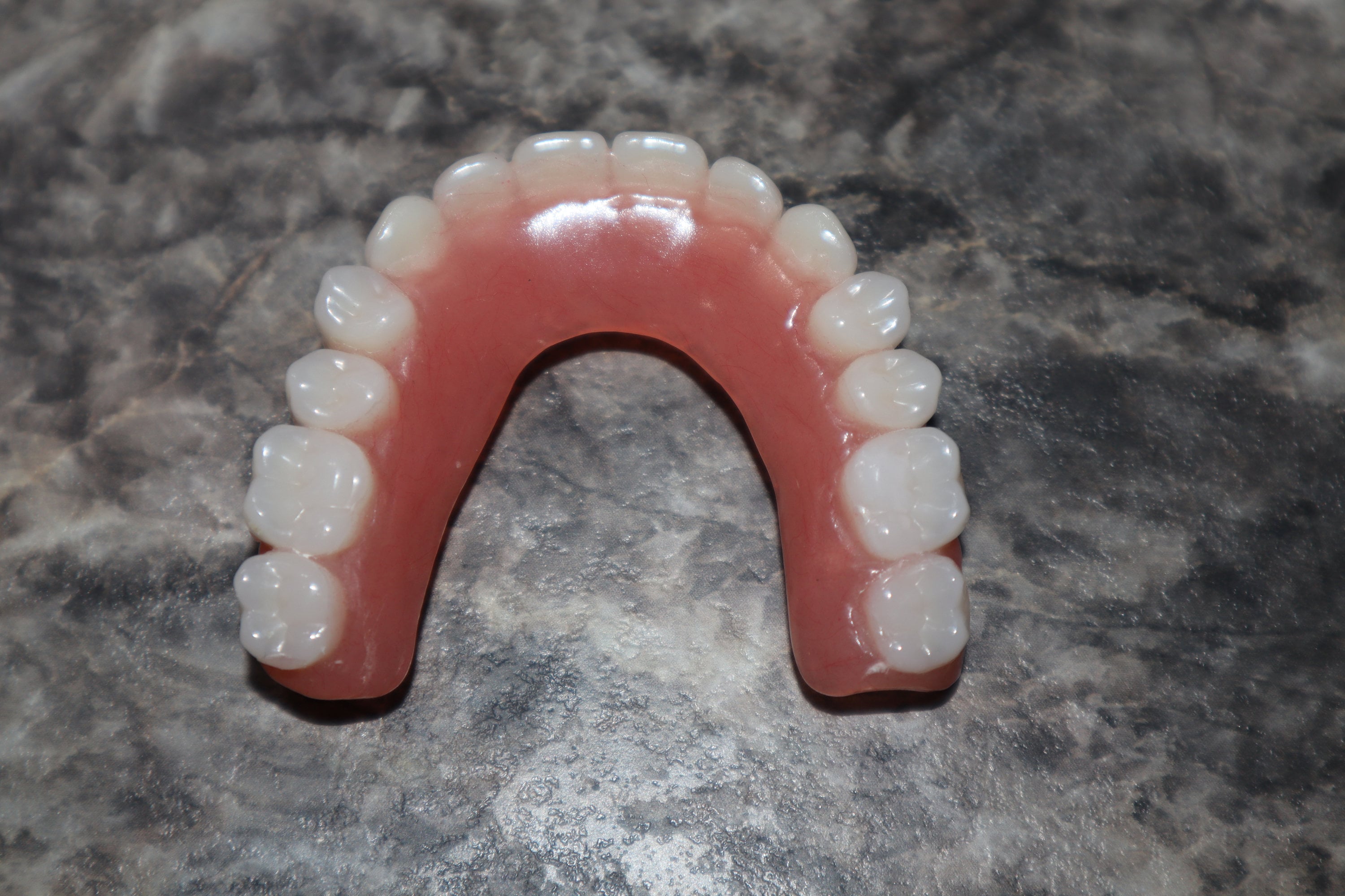 Horseshoe Upper Dentures Without Implantsprivacy - fslp9ww