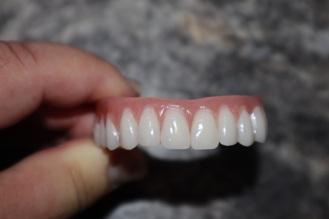 Upper Denture / Horseshoe Upper Dentures /the Denture is Real Etsy