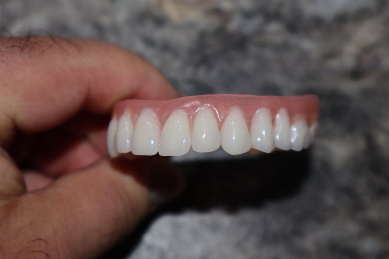 Upper Denture / Horseshoe Upper Dentures /the Denture is Real Etsy Australia