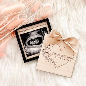 Surprise pregnancy announcement box with personalized ultrasound