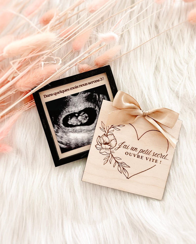 Surprise pregnancy announcement box with personalized ultrasound image 1