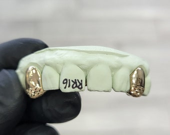 Custom 10k 14k Silver Yellow Rose or White Solid K9 Caps with Diamond Dust Cut Tips Grill Grillz