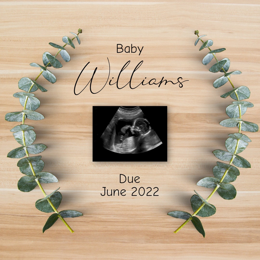 Eucalyptus Pregnancy Announcement Template Parents Family Etsy