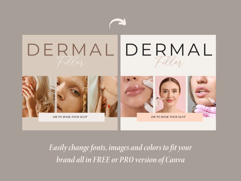 200 Botox and Filler Instagram Templates Botox Templates Etsy Ireland