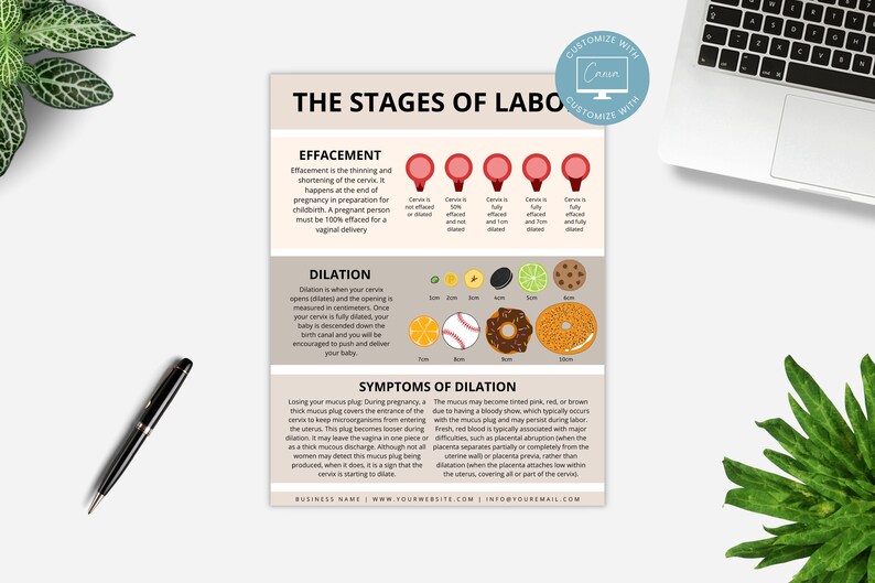 Effacement and Dilation Handout Template, Doula Tool, Birth Education, Doula Template, Labor and Delivery Resource, Labor Process Handout imagen 4