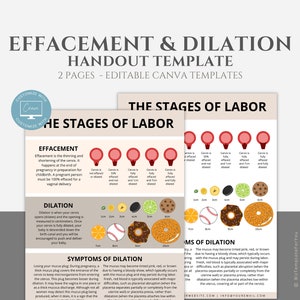 Effacement and Dilation Handout Template, Doula Tool, Birth Education, Doula Template, Labor and Delivery Resource, Labor Process Handout
