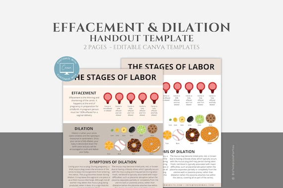 Effacement and Dilation Handout Template, Doula Tool, Birth Education, Doula Template, Labor and Delivery Resource, Labor Process Handout