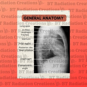 Study Guide, Chest X-ray, Chest Radiograph, Positioning and Procedures ...