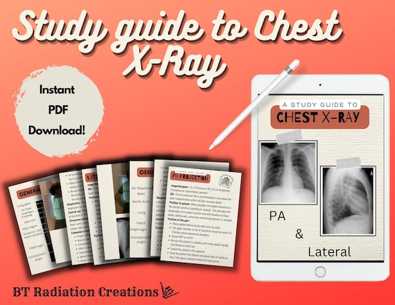 Study Guide Chest X-ray Chest Radiograph Positioning and - Etsy
