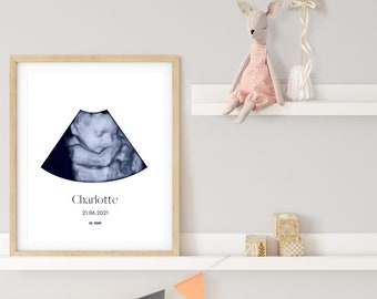 Your personalized ultrasound artwork