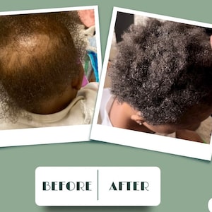 Pflanzliches Haaröl - 100% natürliche Haarpflegelösung. Für alle Haartypen, Haarfollikel stärken, Haarausfall reduzieren, Gesundheit der Kopfhaut.