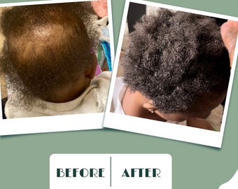 Herbal Hair Growth Oil: Organic Hair Care Solution, Strengthens Follicles