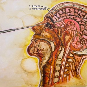 Lobotomy - limited prints