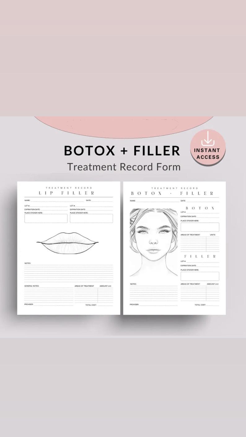 Botox and Dermal Filler Face Injection Patterns Guide, Injector ...