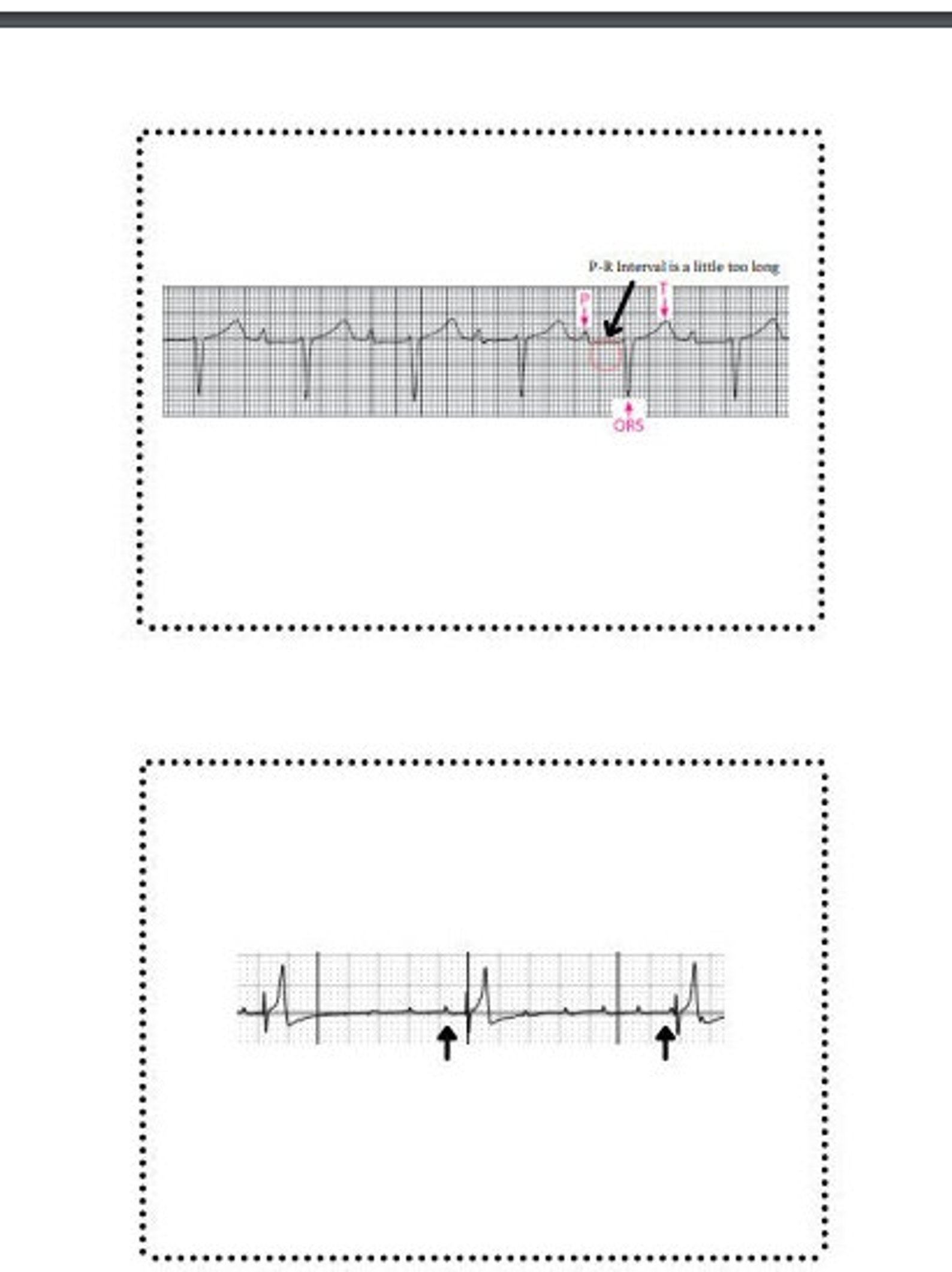 Vet Reference ECG, Vet Tech Pocket Guide , ECG Reference, EKG , Flash ...
