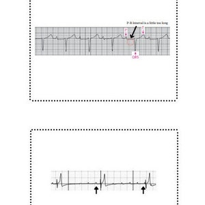 Vet Reference ECG, Vet Tech Pocket Guide , ECG Reference, EKG , Flash ...