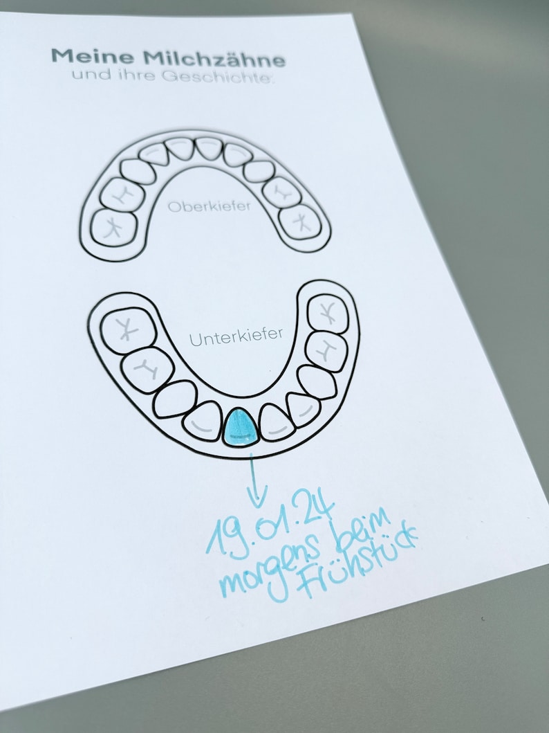 Milchzahn Kalender Wackelzähne Poster Milchzahngebiss Download zum ausdrucken Geschenk von der 