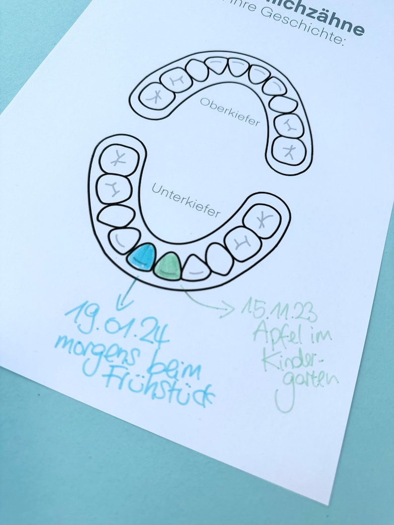 Milchzahn Kalender Wackelzähne Poster Milchzahngebiss Download zum ausdrucken Geschenk von der 