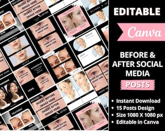 Skincare Before and After Templates, Editable Esthetician Instagram Posts, Skincare Canva Template, Med Spa, Beauty Salon, Cosmetic, Make Up