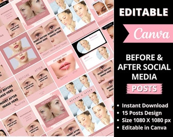 Editable Skincare Before and After Templates, Esthetician Instagram Posts, Cosmetic, Make Up, Med Spa, Beauty Salon, Skincare Canva Template