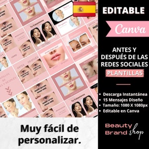 Española Cuidado De La Piel Antes Y Después De Plantillas, Publicaciones De Instagram, Salón De Belleza, Plantilla De Cuidado De La Piel