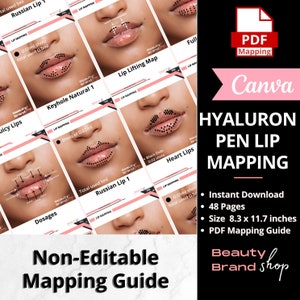 Hyaluron Pen Lip Mapping Training, No Needle Lips, Lip Map, Cupid Bow Lift, Russian Lip, Keyhole Pout Needleless Lip Filler, PDF Print