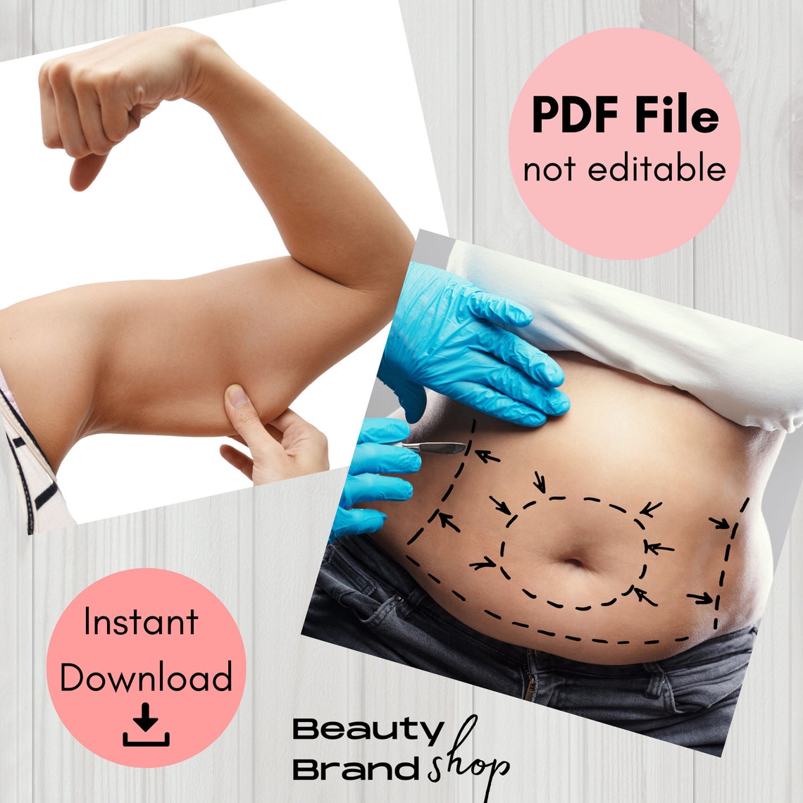 Fat Dissolve Mapping Guide, Fat Dissolving Manual, Fat Mapping, Fat ...