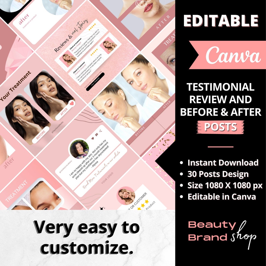Editable Testimonial Review Before and After Instagram - Etsy