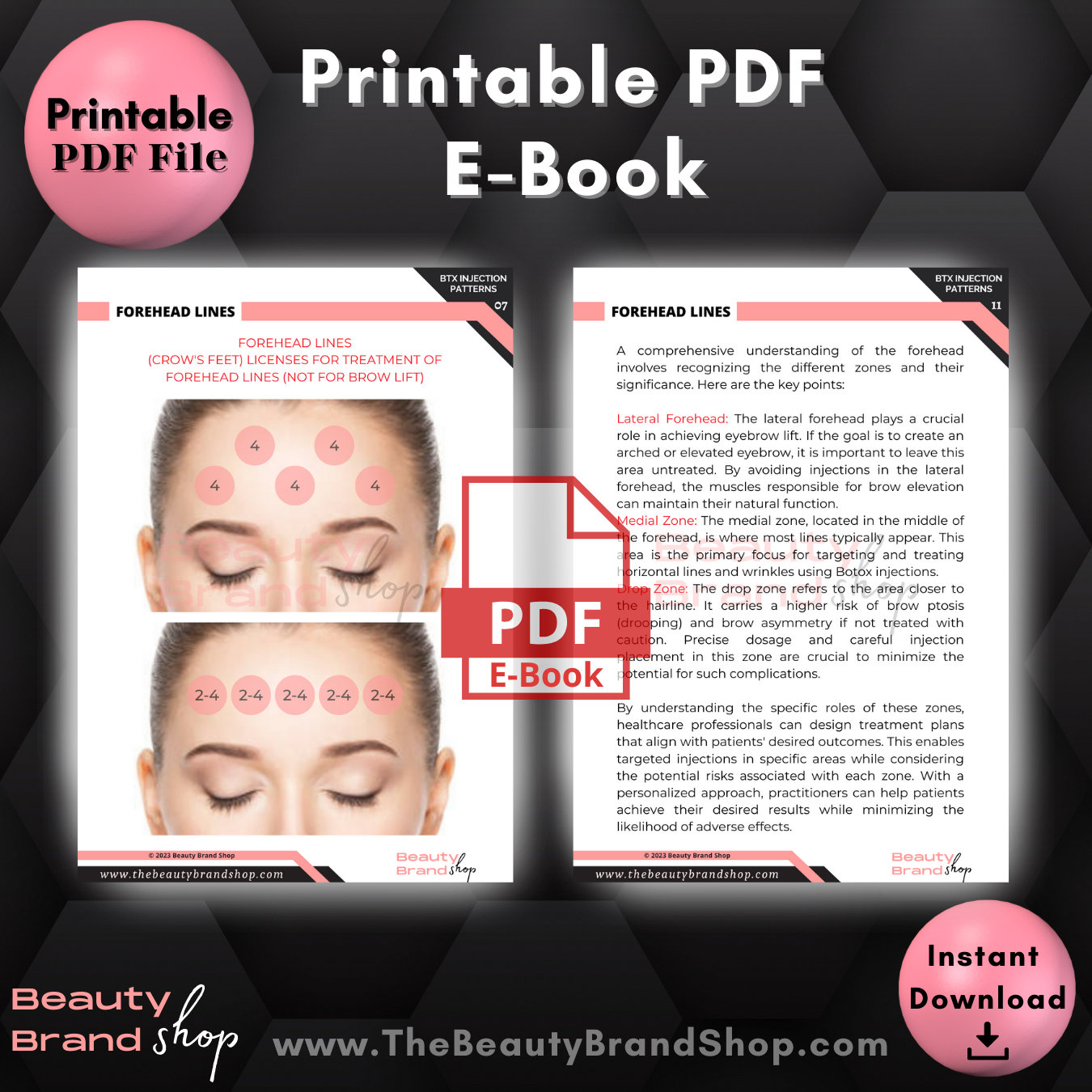 Botox Injecton Pattern For Men Botox Injection Patterns E-book, Cosmetic Injection Training Guide ...