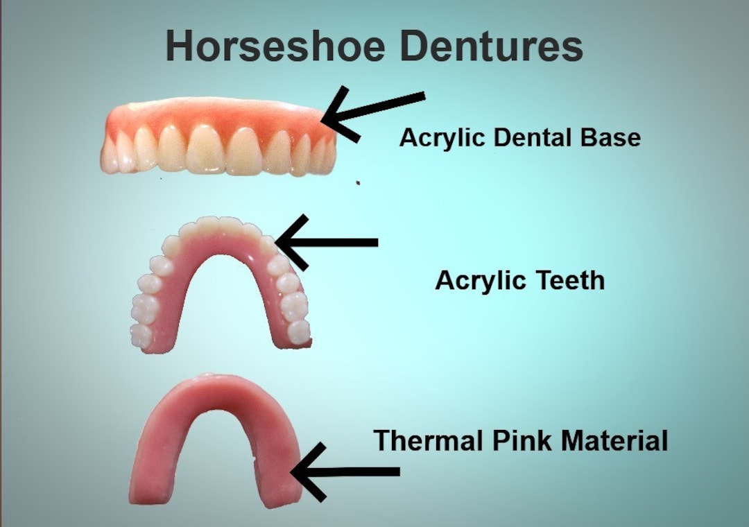 Horseshoe Upper Dentures / the Denture is Real and Wearable If Etsy UK