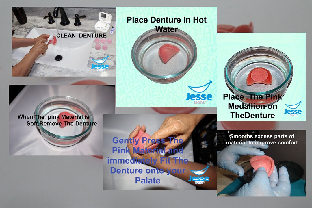 Pink Gum Material ORIGINAL / Denture Diy Denture Reline Etsy UK