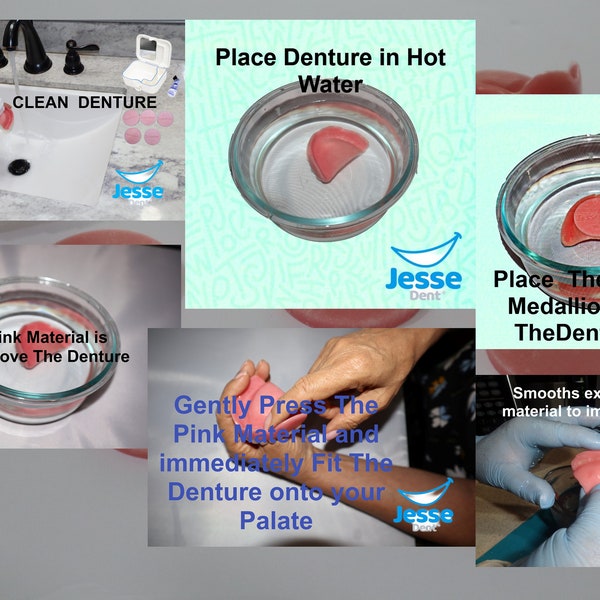 Diy Denture Kit Etsy