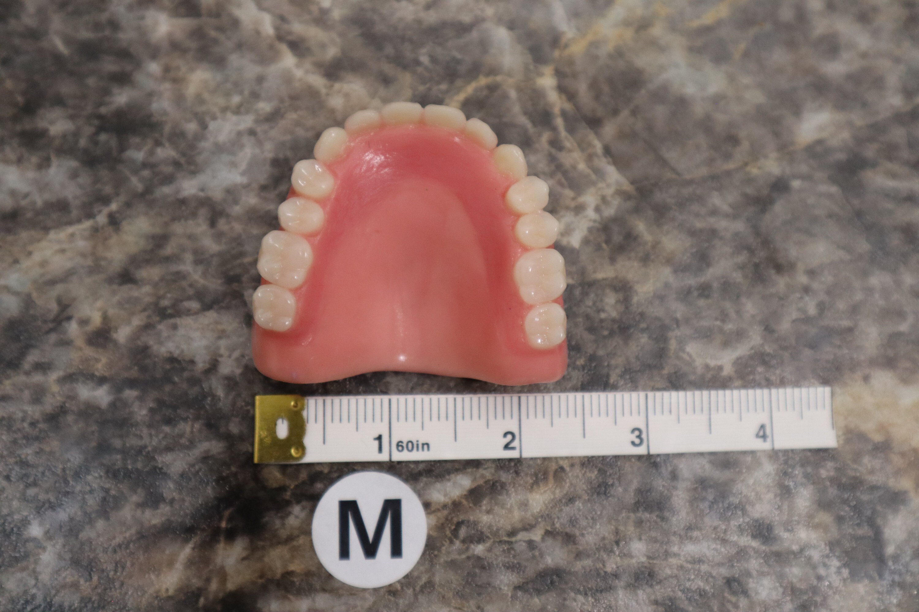 Horseshoe Upper Dentures Without Implantsprivacy - kakph5l